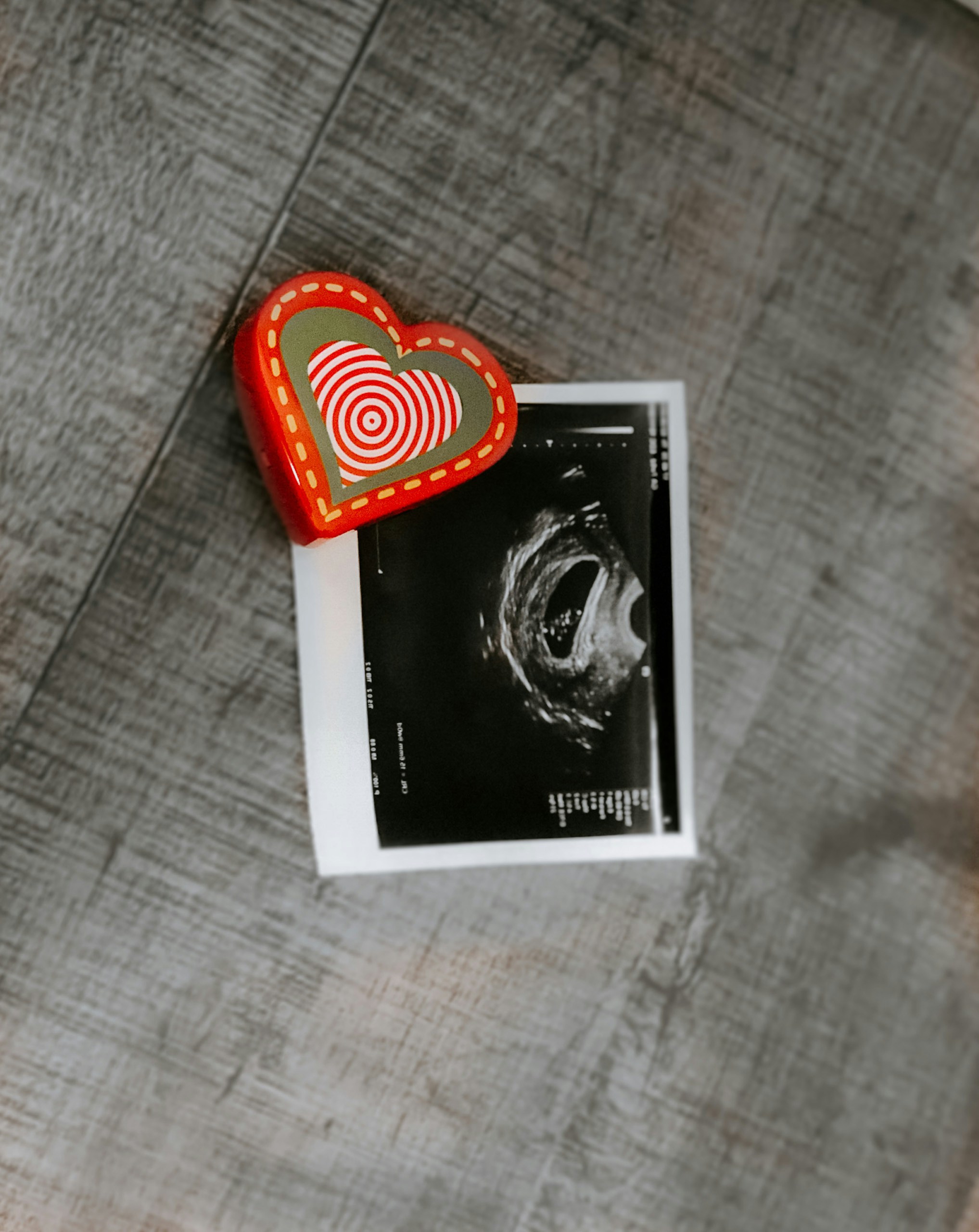 Book excerpt from <em>Abortion and America’s Churches: A Religious History of Roe v. Wade</em>